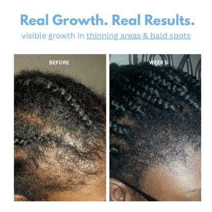 6 in 1 Hair Growth Roll-On Serum